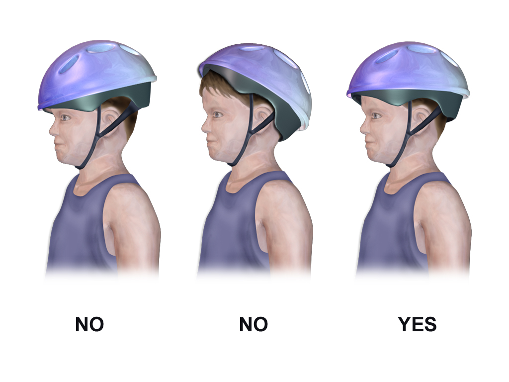 Teen dies after e-bike crash in San Jose, raising new safety concerns